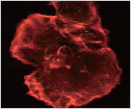 Non-treated group Keratinocyte