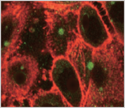 Hyaluronic acid Keratinocyte
