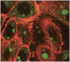 MINEXIN HA Keratinocyte