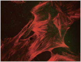 Non-treated group Fibroblast