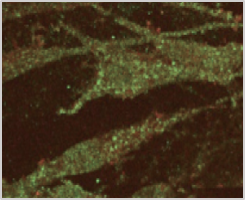 MINEXIN HA Fibroblast