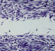 Minoxidil