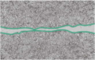 Minexin alpha Keratinocytes
