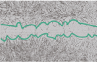Minexin alpha Fibroblasts